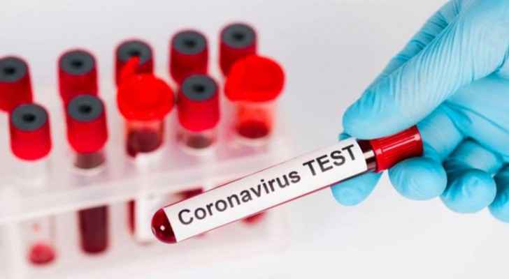 Ramtha contacts of Irbid's COVID-19 patient test negative for virus