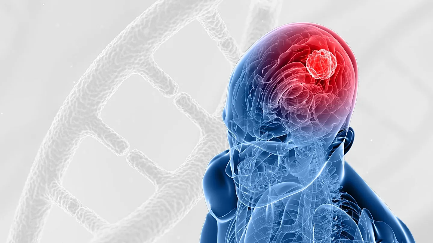 تطوير علاج جديد يُظهر فعالية واعدة ضد أخطر أورام الدماغ
