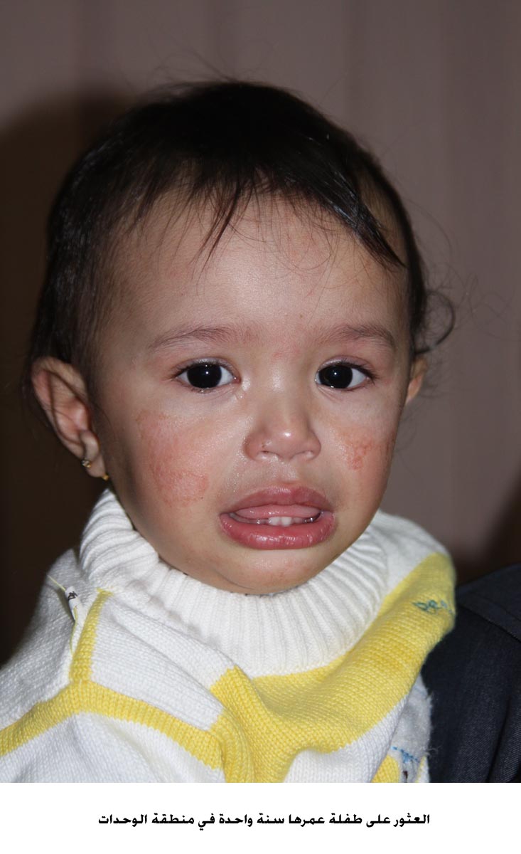 العثور على طفلة عمرها سنة واحدة في منطقة الوحدات