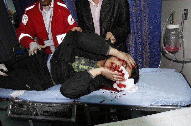 اصابة مواطن فلسطيني بقصف طائرات الاحتلال