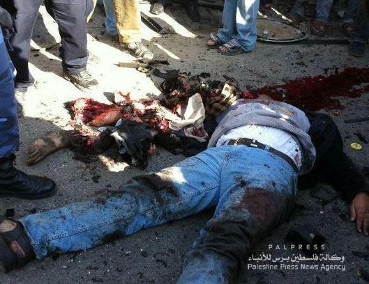 شهيد وجريح في قصف اسرائيلي على غزة