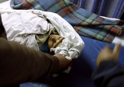 استشهاد فلسطيني متاثرا بجراحه جنوبي غزة