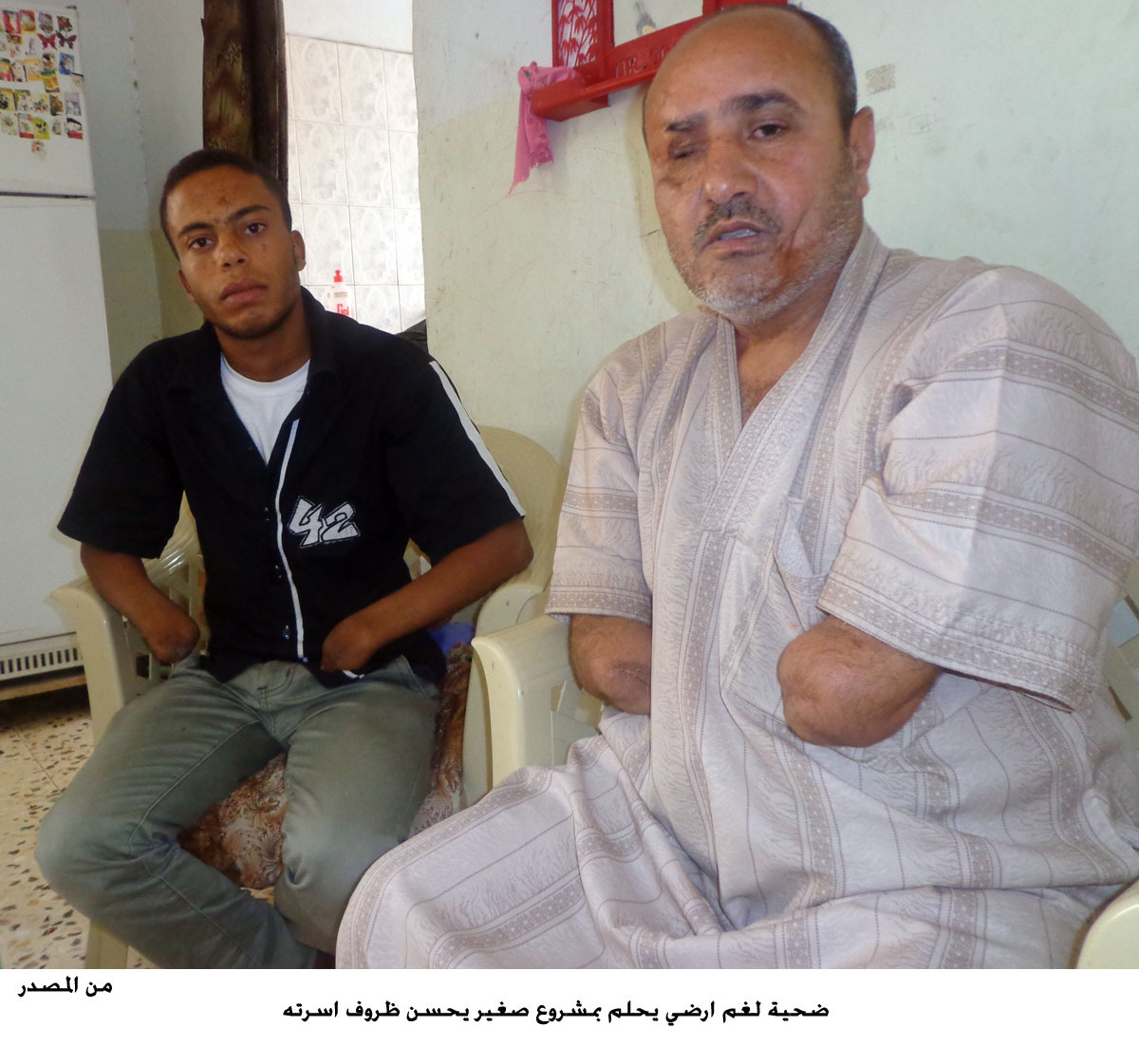 ضحية لغم ارضي يحلم بمشروع صغير يحسن ظروف اسرته