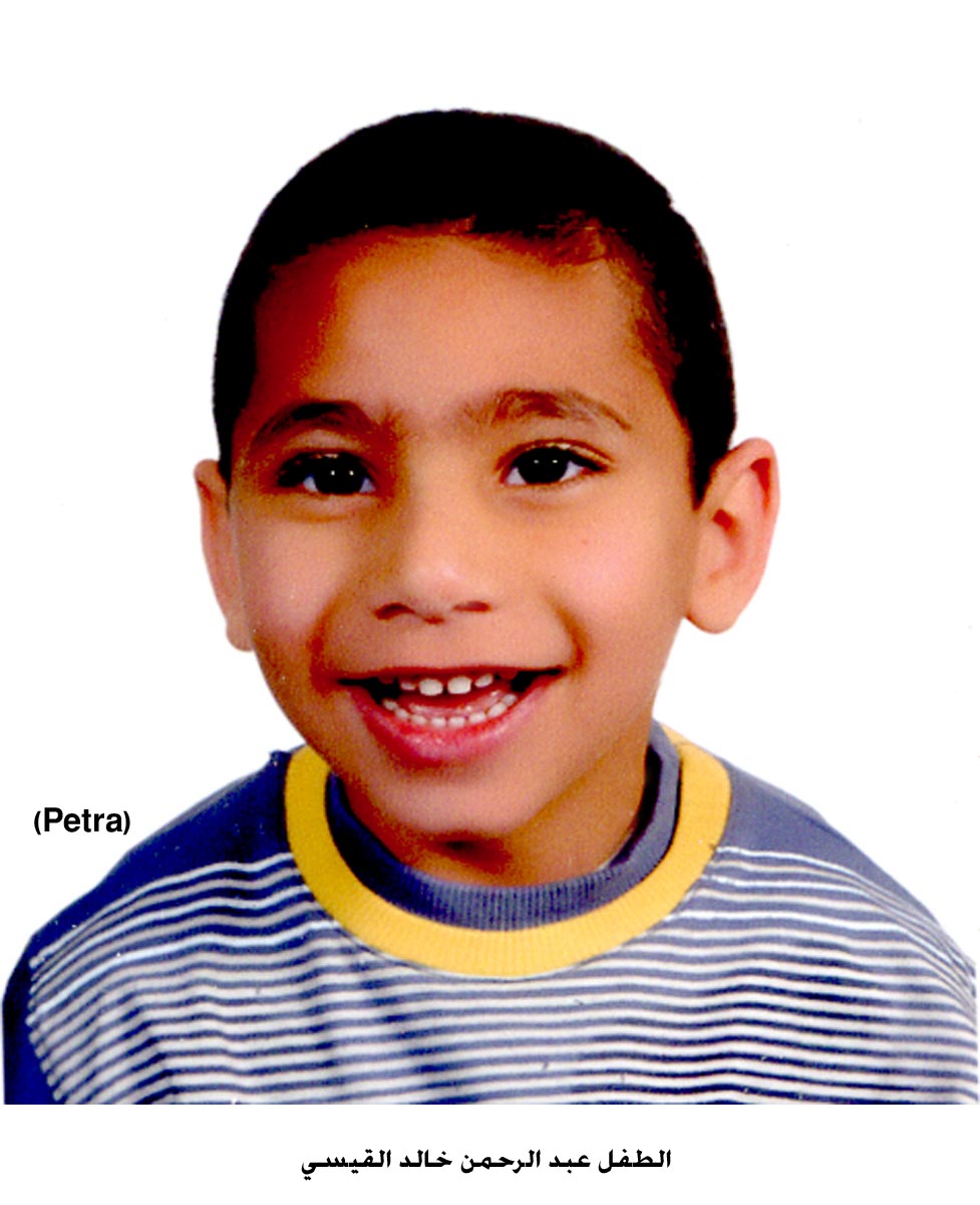 اسرة فقيرة تعجز عن معالجة طفلها الوحيد المصاب بالشلل الدماغي