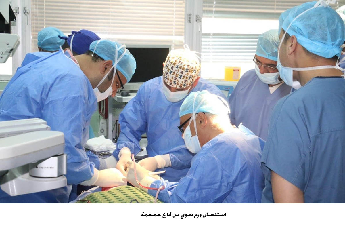 استئصال ورم دموي من قاع جمجمة <br>