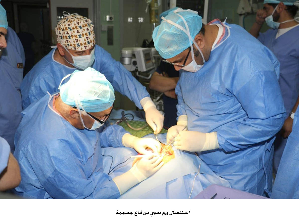 استئصال ورم دموي من قاع جمجمة <br>